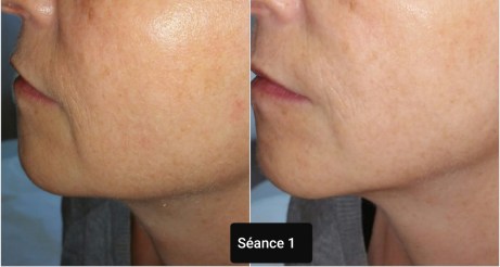 anti age montpellier